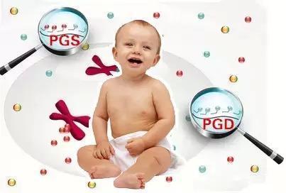 着床前診断 PGT
